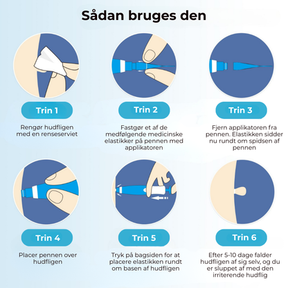 SkinEase™ Pen – Sikker fjernelse af hudmærker!