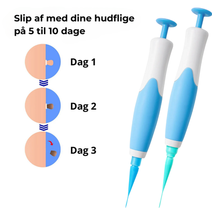 SkinEase™ Pen – Sikker fjernelse af hudmærker!