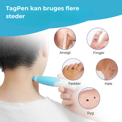 SkinEase™ Pen – Sikker fjernelse af hudmærker!